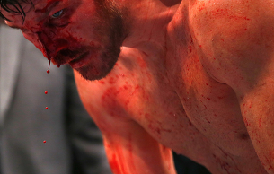 Альдо стал временным чемпионом в полулегком весе UFC