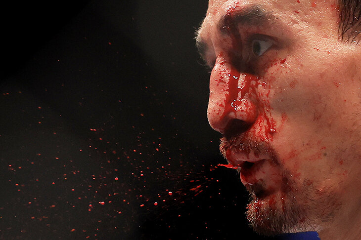 Волкановски закрыл трилогию с Холлоуэем в UFC. Превратил лицо Макса в кровавую кашу и доказал, что он лучший в дивизионе 