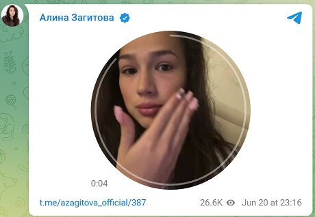 Загитова рассказала об опухающих глазах после сна: Иногда бывает такое, что вообще не вижу ничего